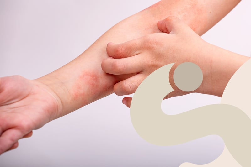 Dermatite atopica: cause, sintomi e rimedi efficaci per gestirla