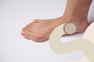 Alluce valgo: cause, sintomi, rimedi e intervento