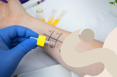 Test allergici: quali fare e come funzionano per ogni tipo di allergia