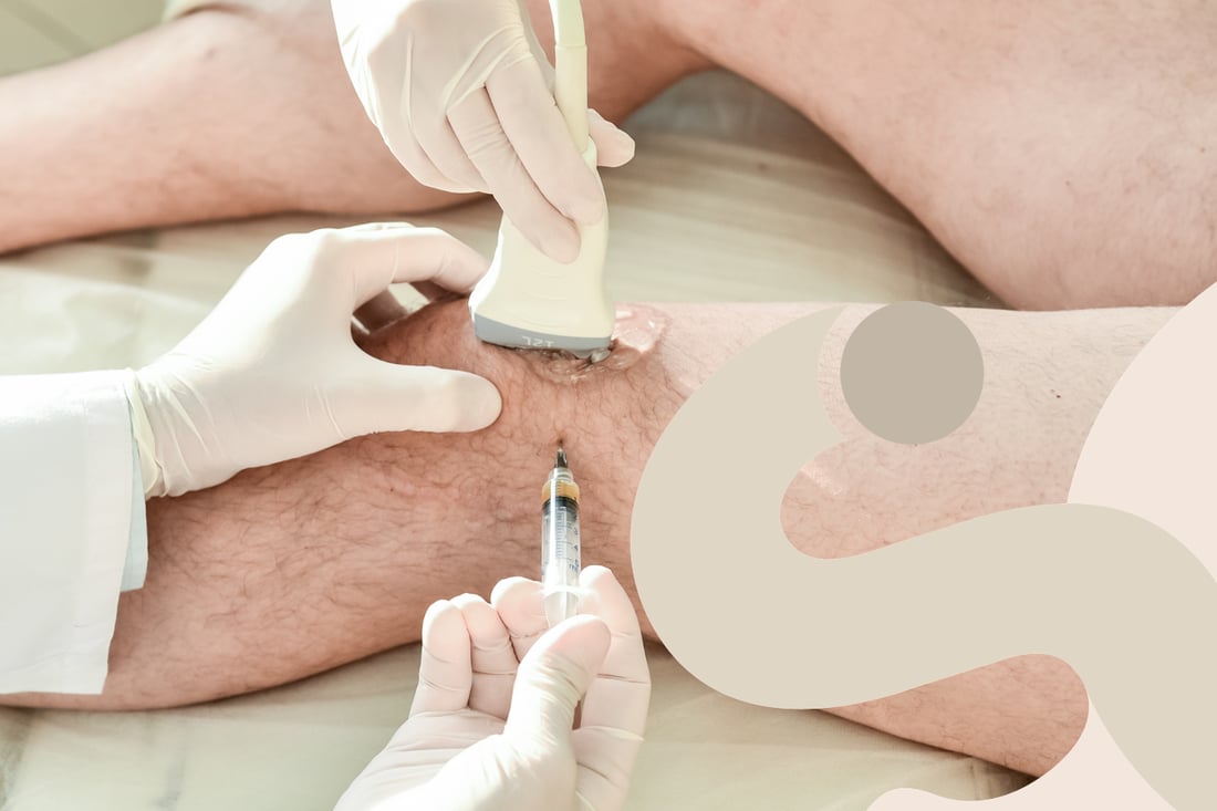 Infiltrazioni ecoguidate: approccio innovativo per patologie muscolo-scheletriche e neurogene