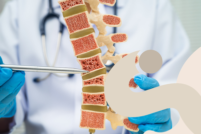 Osteoporosi: conoscere i fattori di rischio e prevenire le fratture